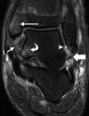Figure 7b