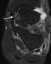 Figure 11c