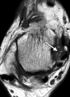 Figure 12d