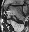 Figure 1b