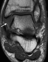Figure 7a