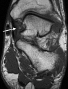 Figure 11b