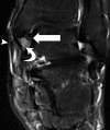 Figure 2a