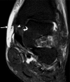 Figure 5b