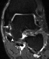 Figure 6a