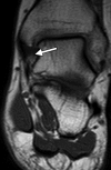 Figure 1a