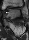 Figure 3a