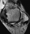 Figure 1c