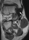 Figure 9a