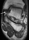 Figure 10a