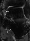 Figure 3b
