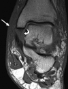 Figure 5a