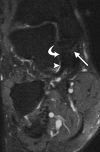 Figure 9b