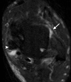 Figure 9d
