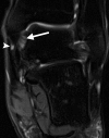 Figure 2b