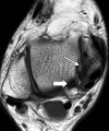 Figure 12b