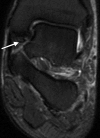 Figure 10b