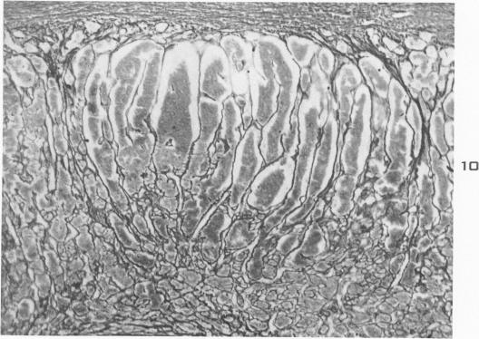 Fig. 10