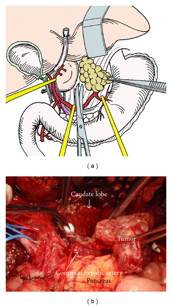 Figure 11