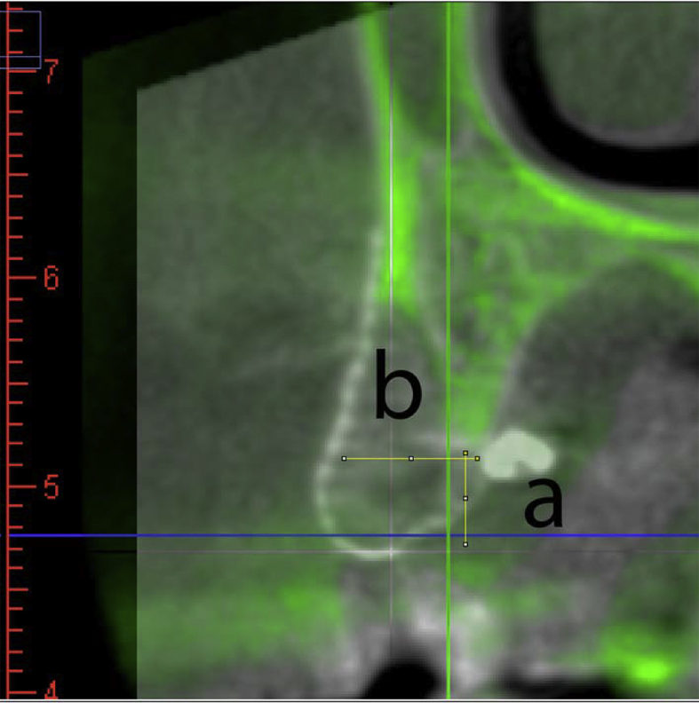 Figure 3