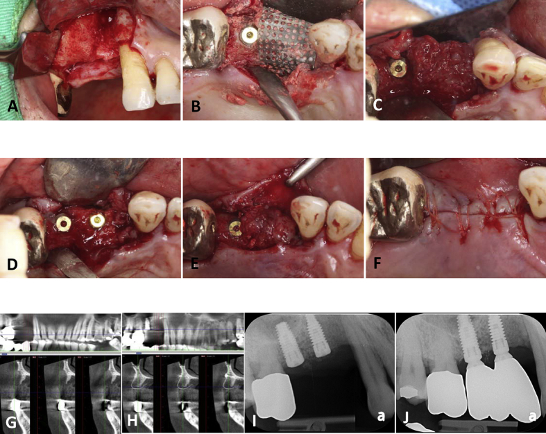 Figure 1