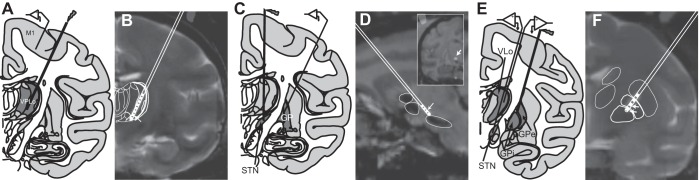 Fig. 1.