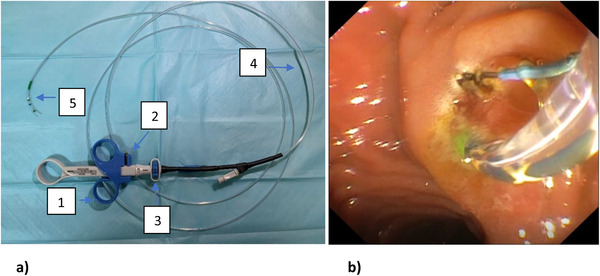 FIGURE 2