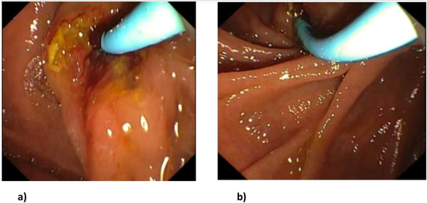 FIGURE 4