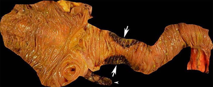 Fig. 2