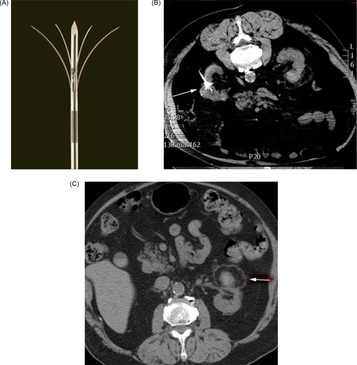 Figure 3: