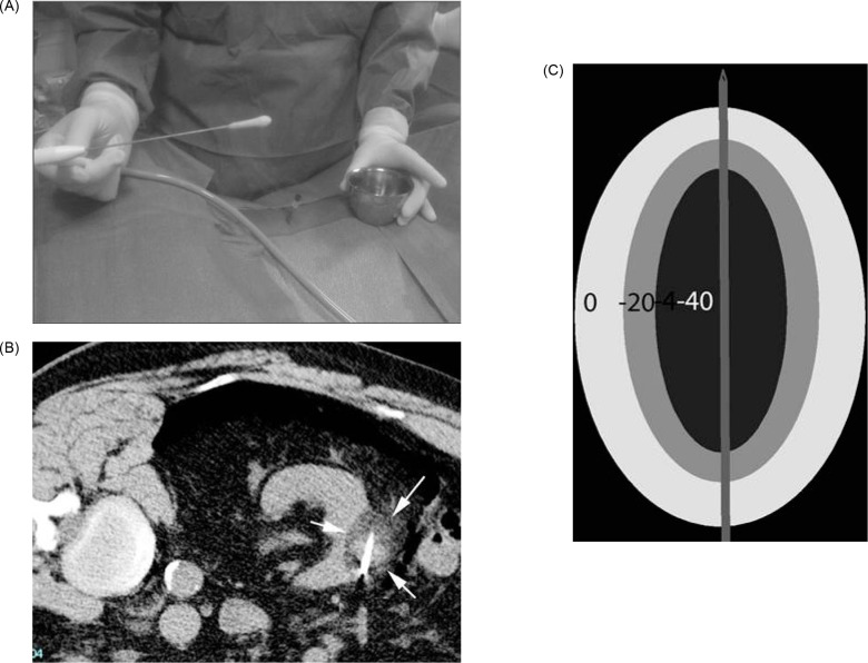 Figure 1: