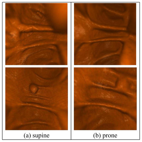 Fig. 12