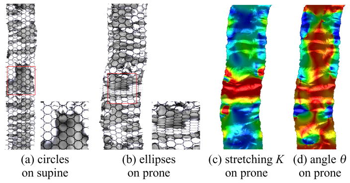 Fig. 14