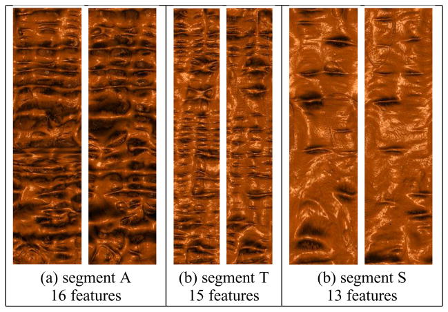 Fig. 11