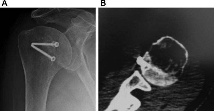 Fig. 5