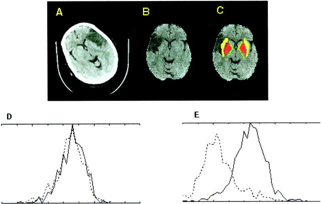 fig 1.