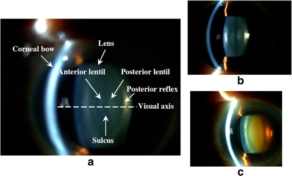 Figure 13