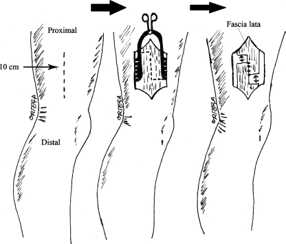 Fig. 1