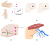 Fig 1