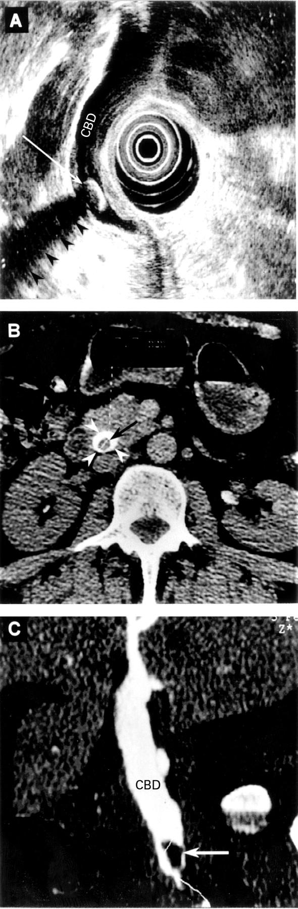 Figure 2  