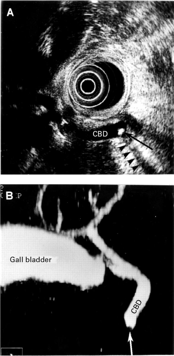 Figure 1  