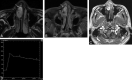 Fig 2.