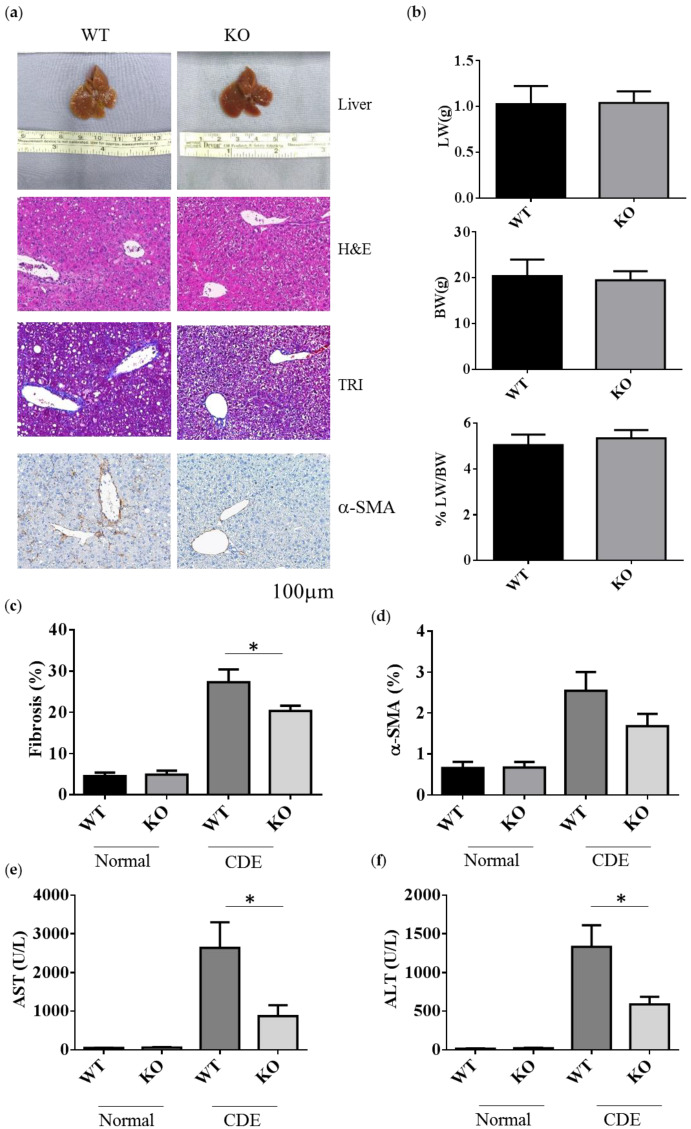 Liver Fibrosis and Inflammation under the Control of ERK2 - PMC