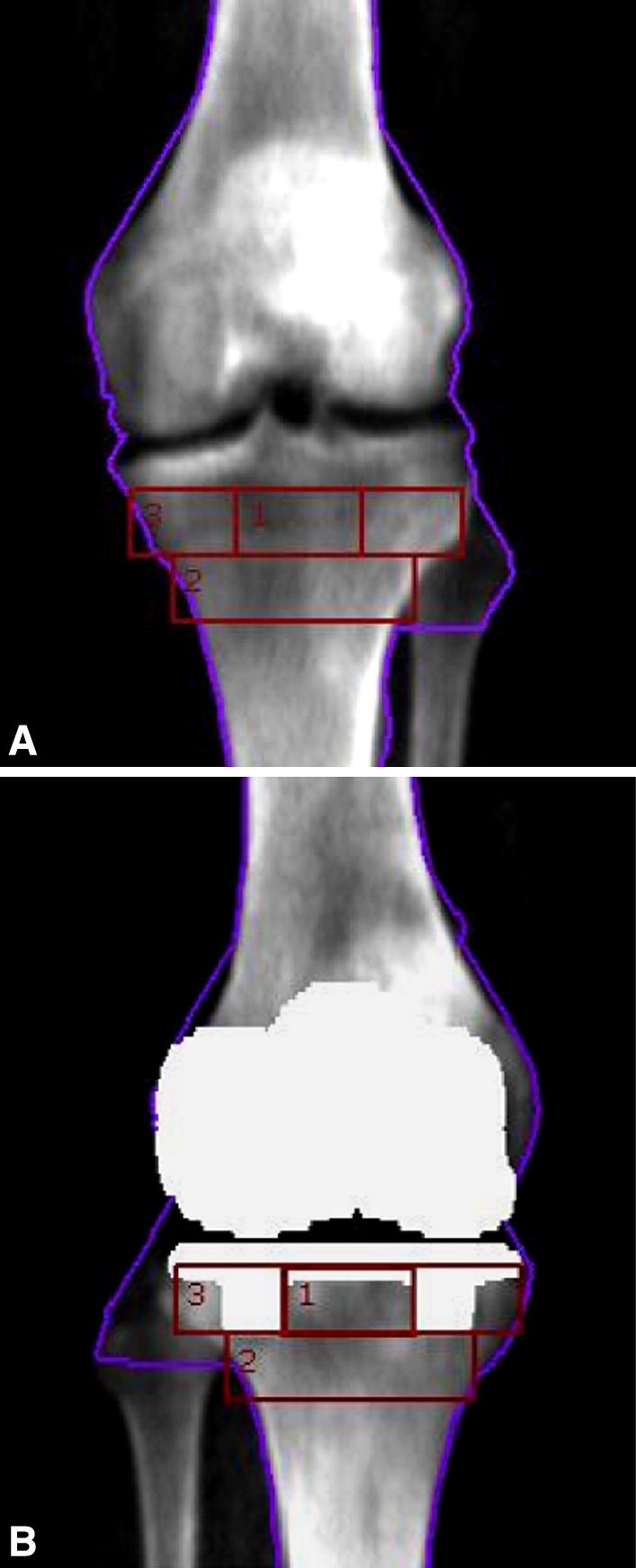 Fig. 2A–B