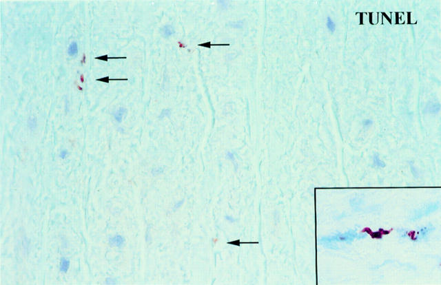 Figure 3  