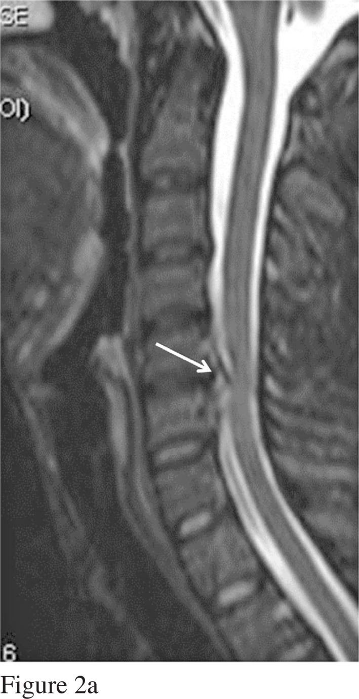 Figure 2: