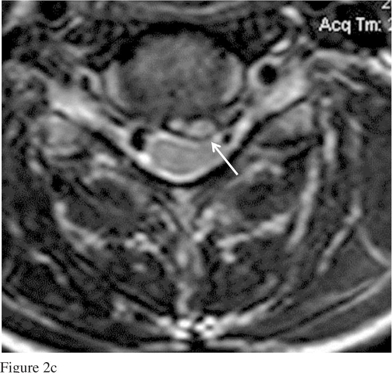 Figure 2: