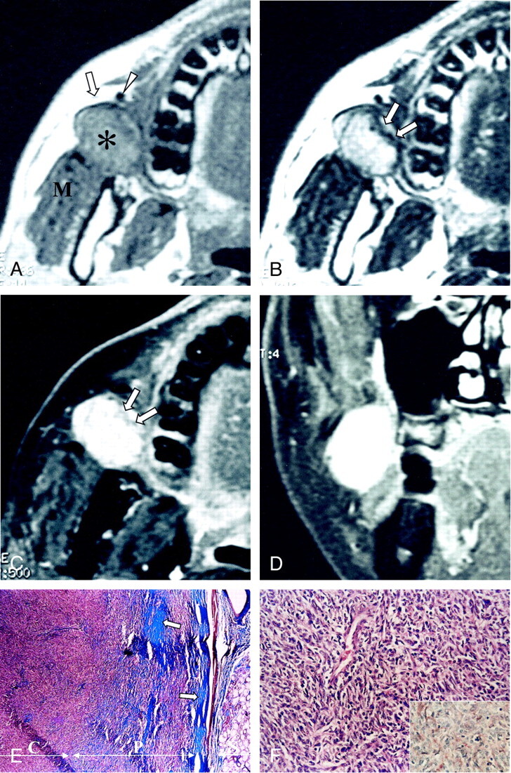 fig 1.