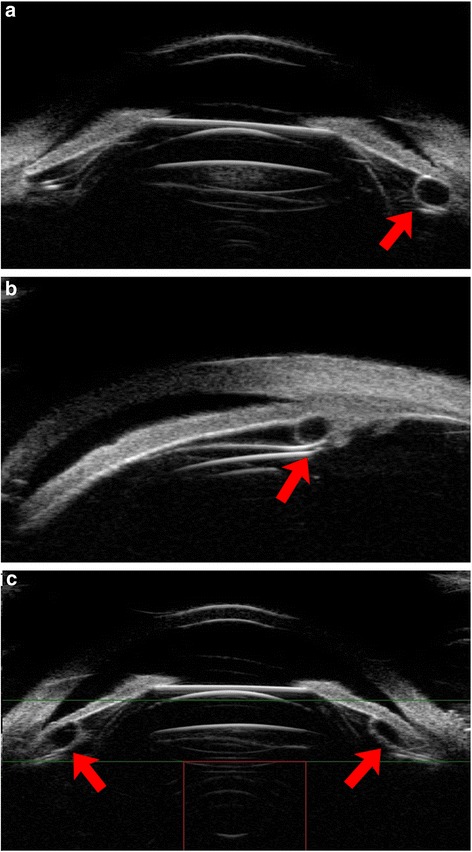 Fig. 11