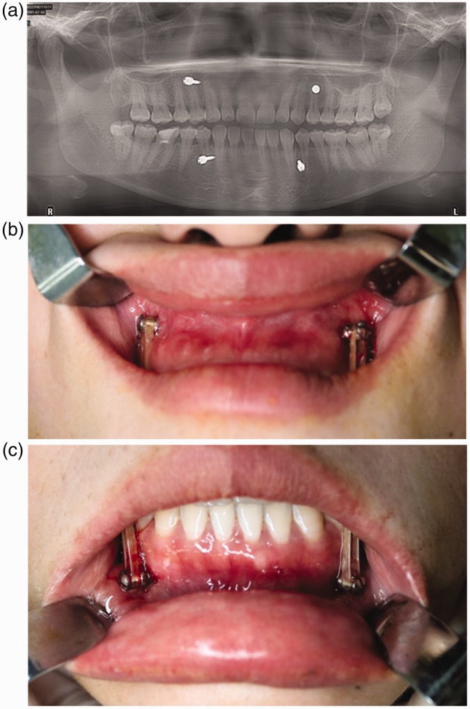 Figure 2.